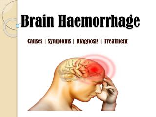 Brain Haemorrhage: Symptoms, causes, diagnosis and treatment