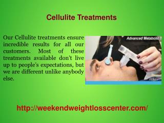 Cellulite Treatments