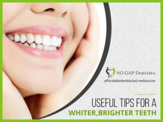 4 Tips for Bright & White Teeth