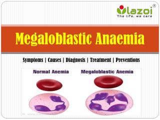 Megaloblastic Anaemia: Symptoms, causes, diagnosis, treatment and preventions.