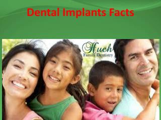 Dental Implants Facts