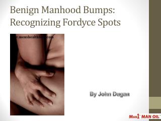 Benign Manhood Bumps: Recognizing Fordyce Spots