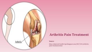 Arthritis Pain Treatment