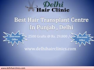 Change your look and Say good Bye baldness hair transplant in clinic Punjab