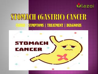 Stomach (Gastric) Cancer: Causes, symptoms, diagnosis, and treatment.