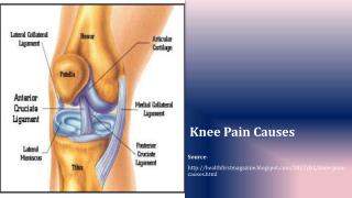 Knee Pain Causes