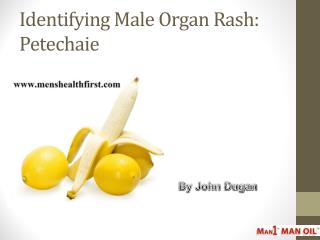 Identifying Male Organ Rash: Petechaie