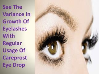 See The Variance In Growth Of Eyelashes With Regular Usage Of Careprost Eye Drop