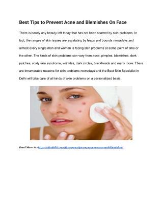 Best Tips to Prevent Acne and Blemishes On Face