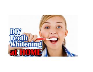 How To Whiten Teeth At Home, Home Remedies For Whitening Teeth, How To Have Whiter Teeth