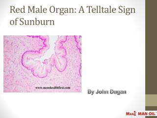 Red Male Organ: A Telltale Sign of Sunburn