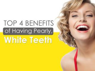 Top 4 Benefits of Having Pearly, White Teeth
