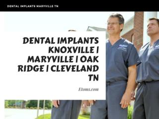 Dental Implants Maryville TN