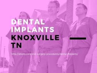 Dental Implants Knoxville TN