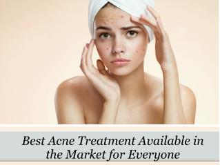 Best Acne Treatment Available in the Market for Everyone