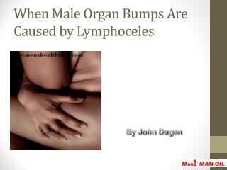 When Male Organ Bumps Are Caused by Lymphoceles