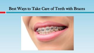 Best Ways to Take Care of Teeth with Braces