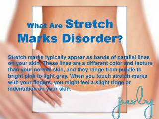 Laser Stretch Marks Removal Treatment | Stretch Mark Therapy