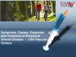Symptoms and Treatment of PAD – USA Vascular Centers