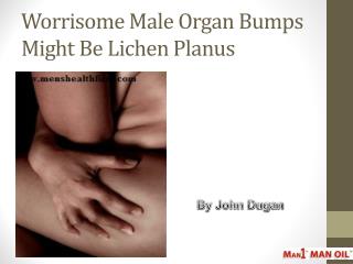 Worrisome Male Organ Bumps Might Be Lichen Planus