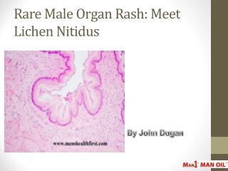 Rare Male Organ Rash: Meet Lichen Nitidus