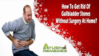 How To Get Rid Of Gallbladder Stones Without Surgery At Home?