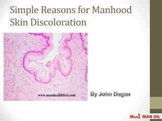 Simple Reasons for Manhood Skin Discoloration