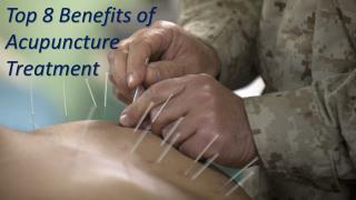 Top 8 benefits of Acupuncture Treatment