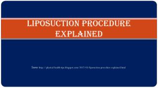 Liposuction Procedure Explained