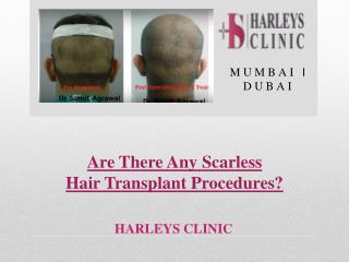 Are There Any Scarless Hair Transplant Procedures?