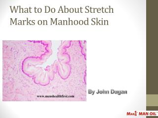 What to Do About Stretch Marks on Manhood Skin