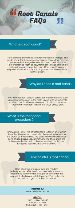 Root Canals FAQs