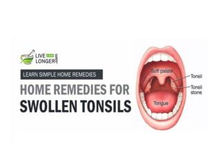 Home Remedies For Swollen Tonsils