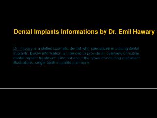 Dental Implants Information