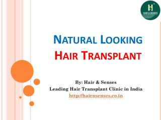 Natural Looking Hair Transplant