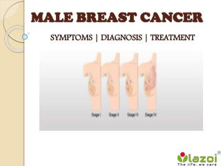 Male Breast Cancer : Symptoms, diagnosis and treatment