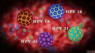 HUMAN PAPILLOMAVIRUS (HPV)