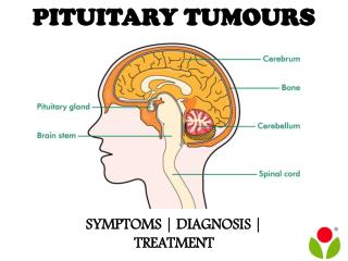 Pituitary tumours : symptoms, diagnosis and treatment