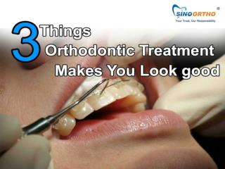 3 Things Orthodontic Treatment Makes You Look good