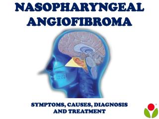 Nasopharyngeal Angiofibroma: Symptoms, causes, diagnosis and treatment