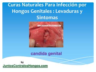 Curas naturales para infección por hongos genitales levaduras y sintomas hombres mujeres niños