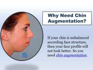 Chin Augmentation Treatments in New York