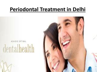 Periodontal Treatment in Delhi