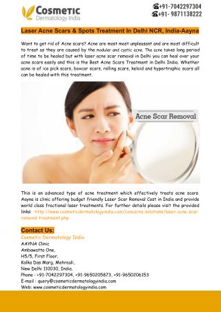 Laser Acne Scars & Spots Treatment In Delhi NCR, India-Aayna