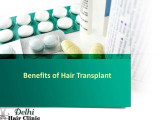 Benefits of doing Hair transplant