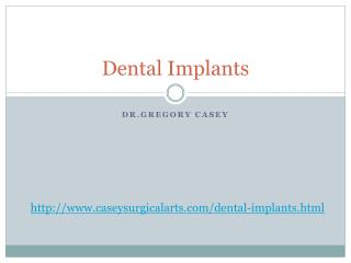 Dental Implants by Dr. Gregory Casey
