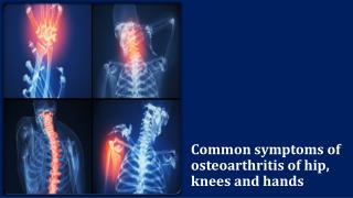 Common symptoms of osteoarthritis of hip, knees and hands