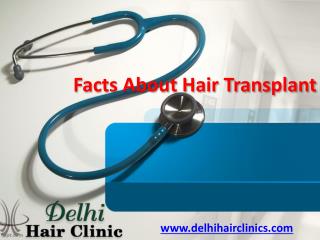 Facts About Hair Transplant