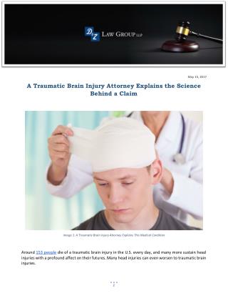 A Traumatic Brain Injury Attorney Explains the Science Behind a Claim