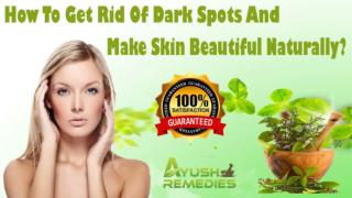 How To Get Rid Of Dark Spots And Make Skin Beautiful Naturally?